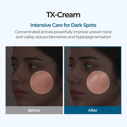 TX Cream 50ml